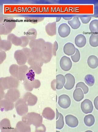 PLASMODIUM MALARIE 
