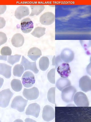 PLASMODIUM MALARIE TROFOZOITOS 