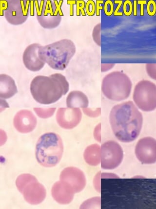 P . VIVAX TROFOZOITO 