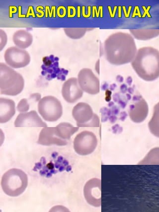 PLASMODIUM VIVAX 