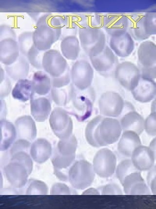 T . CRUZY 