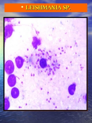 LEISHMANIA SP. 