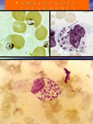 AMASTIGOTE LEISHMANIA SPP. 