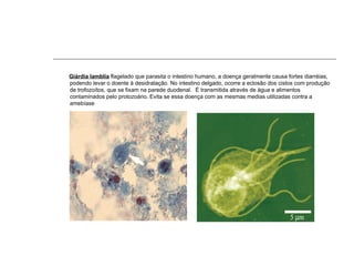 Giárdia lamblia flagelado que parasita o intestino humano, a doença geralmente causa fortes diarréias,
podendo levar o doente à desidratação. No intestino delgado, ocorre a eclosão dos cistos com produção
de trofozoítos, que se fixam na parede duodenal. É transmitida através de água e alimentos
contaminados pelo protozoário. Evita se essa doença com as mesmas medias utilizadas contra a
amebíase
 