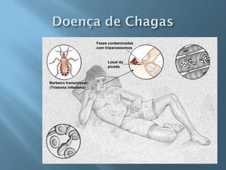 Fezes contaminadas
                       com tripanossomos


                            Local da
                            picada



Barbeiro transmissor
(Triatoma infestans)
 