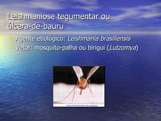 Leishmaniose tegumentar ou úlcera-de-bauru Agente etiológico:  Leishmania brasiliensis Vetor: mosquito-palha ou birigui ( Lutzomya ) 