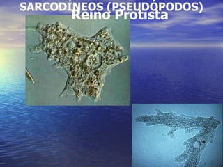 SARCODÍNEOS (PSEUDÓPODOS) Reino Protista 