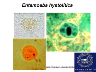 FUNDACION BAARCELO FACULTAD DE MEDICINA
Entamoeba hystolítica
 