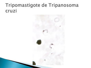 Protozoarios tisulares