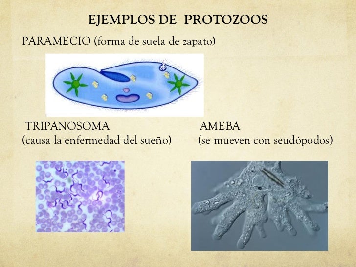Resultat d'imatges de protozoos