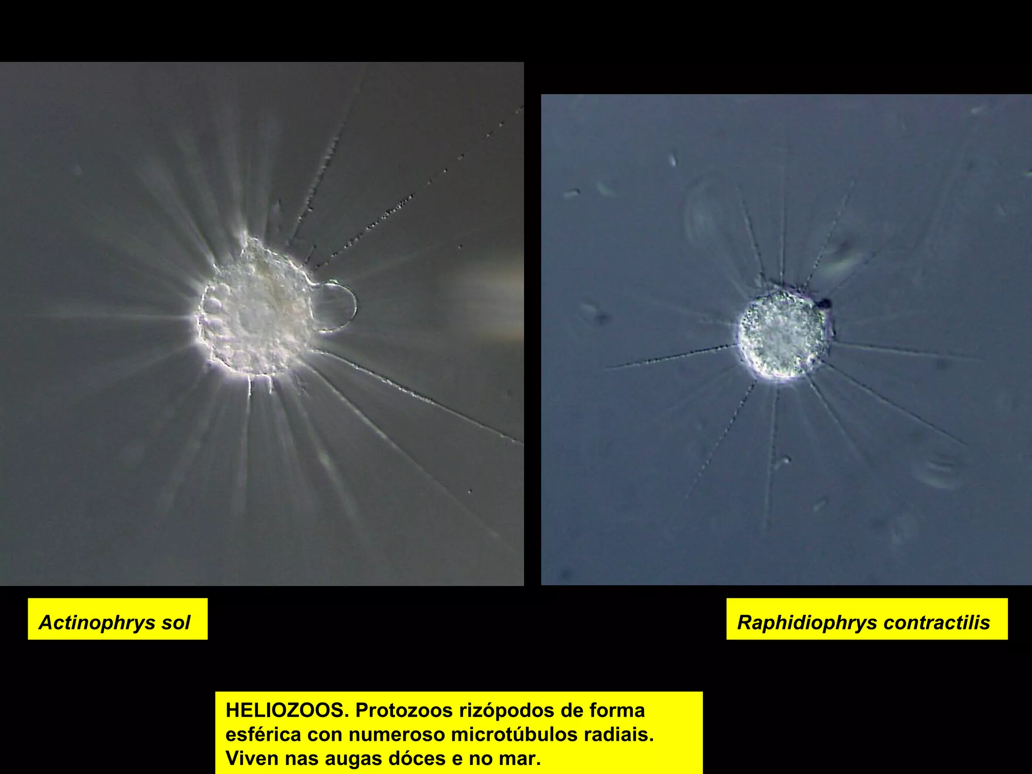 Actinophrys sol

Raphidiophrys contractilis

paramecio Protozoos rizópodos de forma
HELIOZOOS.
esférica con numeroso microtúbulos radiais.
Viven nas augas dóces e no mar.

 