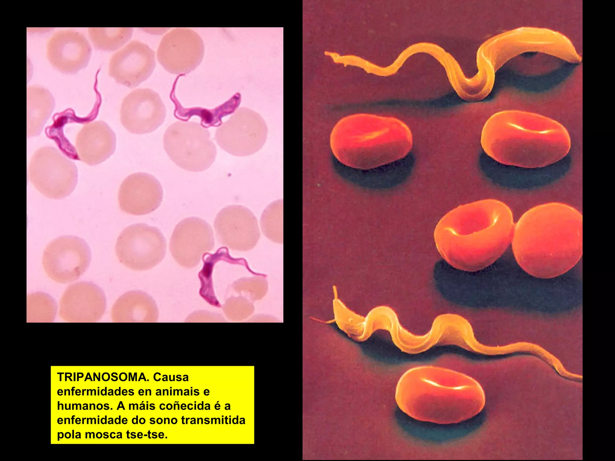 TRIPANOSOMA. Causa
enfermidades en animais e
humanos. A máis coñecida é a
enfermidade do sono transmitida
pola mosca tse-tse.

 