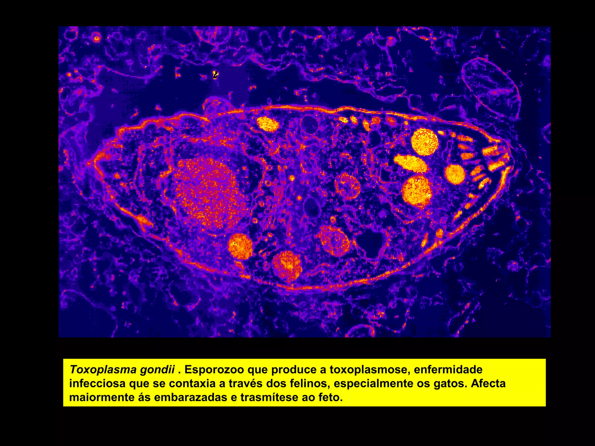 Toxoplasma gondii . Esporozoo que produce a toxoplasmose, enfermidade
infecciosa que se contaxia a través dos felinos, especialmente os gatos. Afecta
maiormente ás embarazadas e trasmítese ao feto.

 