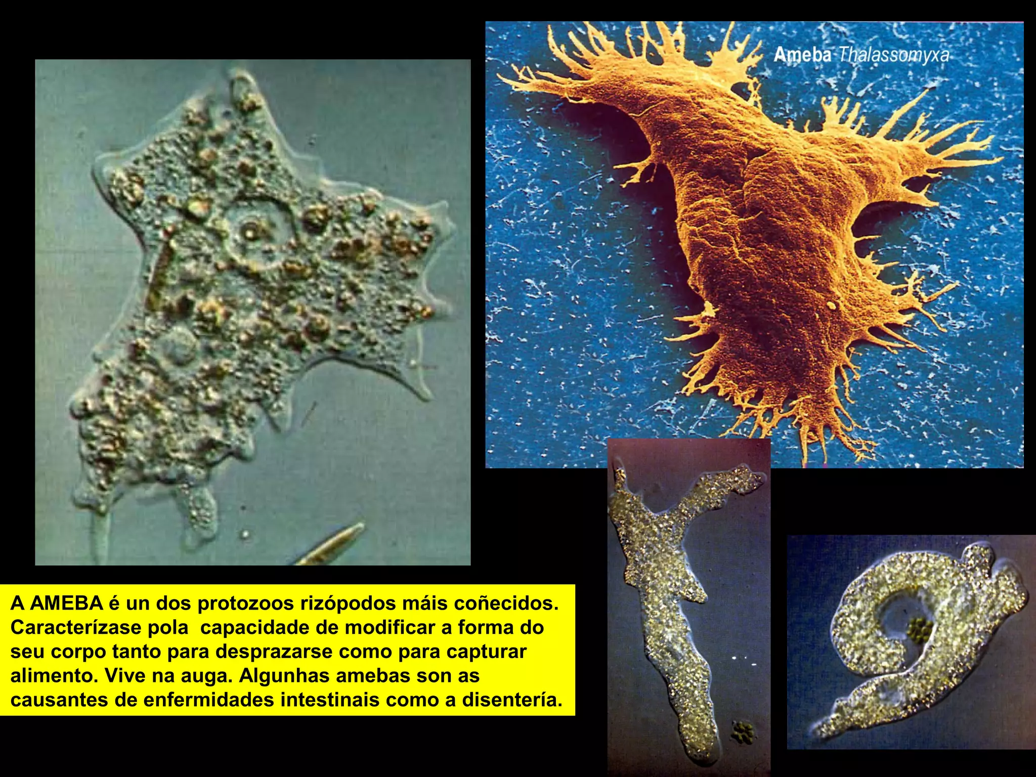 A AMEBA é un dos protozoos rizópodos máis coñecidos.
Caracterízase pola capacidade de modificar a forma do
seu corpo tanto para desprazarse como para capturar
alimento. Vive na auga. Algunhas amebas son as
causantes de enfermidades intestinais como a disentería.

paramecio

 
