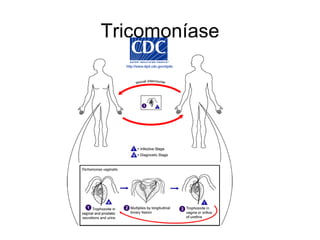 Tricomoníase 