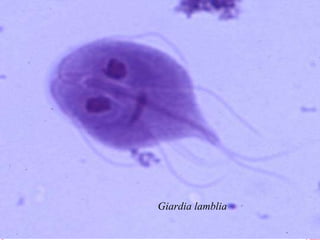 Giardia lamblia 