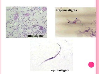 amastigota tripomastigota epimastigota 