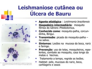 Leishmaniose cutânea ou
     Úlcera de Bauru
         Agente etiológico : Leishmania braziliensis
         Hospedeiro intermediário: mosquito
          fêmea do Gênero Phlebotomus.
         Conhecido como: mosquito-palha, corcun-
          dinha, Birigui.
         Transmissão: picada do mosquito-palha –
          na saliva.
         Sintomas: Lesões na mucosa da boca, nariz
          e faringe.
         Prevenção: uso de telas, mosquiteiros, repe-
          lentes, combate ao mosquito, casa longe da
          matas e Vacinas.
          Tratamento a tempo, regride as lesões.
         Habitat: pele, mucosas do nariz, boca,
          cartilagens e ossos
 