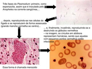 Três fases do Plasmodium: primeiro, como
 esporozoíta, assim que é inoculado pelo
 Anopheles na corrente sangüínea,...



... depois, reproduzindo-se nas células do
fígado e se reproduzem de forma assexuada
(grande mancha vermelha ao centro)...
                                           ... e, finalmente, invadindo, reproduzindo-se e
                                           destruíndo os glóbulos vermelhos
                                           – na imagem, os círculos em abóbora
                                           representam hemácias, sendo que aquelas
                                           com pequenos pontos vermelhos estão
                                           infectadas




 Essa forma é chamada merozoito
 