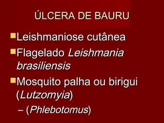 ÚLCERA DE BAURU
Leishmaniose cutânea
Flagelado Leishmania
 brasiliensis
Mosquito palha ou birigui
 (Lutzomyia)
 – (Phlebotomus)
 
