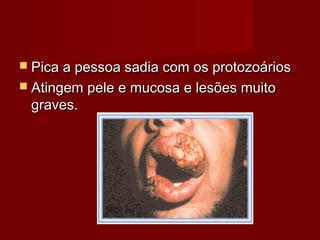  Pica a pessoa sadia com os protozoários
 Atingem pele e mucosa e lesões muito
 graves.
 