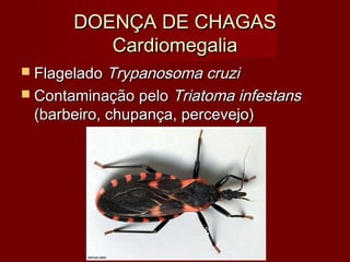 DOENÇA DE CHAGAS
         Cardiomegalia
 Flagelado Trypanosoma cruzi
 Contaminação pelo Triatoma infestans
 (barbeiro, chupança, percevejo)
 