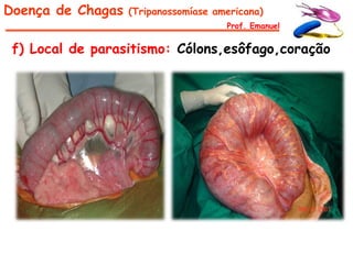 Doença de Chagas   (Tripanossomíase americana)
                                      Prof. Emanuel


 f) Local de parasitismo: Cólons,esôfago,coração
 
