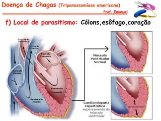 Doença de Chagas   (Tripanossomíase americana)
                                      Prof. Emanuel


 f) Local de parasitismo: Cólons,esôfago,coração
 