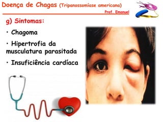 Doença de Chagas   (Tripanossomíase americana)
                                      Prof. Emanuel

 g) Sintomas:
 • Chagoma
 • Hipertrofia da
 musculatura parasitada
 • Insuficiência cardíaca
 