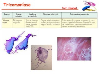 Tricomoníase
               Prof. Emanuel
 