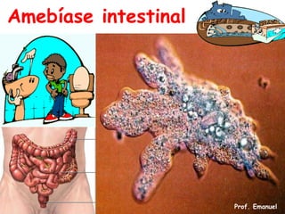 Amebíase intestinal




                      Prof. Emanuel
 