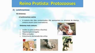 3) Leishmaniose
VI) Sintomas:
c) Leishmaniose canina
o A maioria dos cães contaminados não apresentam os sintomas da doença,
embora atuem como reservatórios.
Sintomas mais comuns:
o Lesões na pele (orelhas e focinho)
o Hepatoesplenomegalia
o Pêlos ouriçados
o Crescimento demasiado das unhas
Reino Protista: Protozooses
 