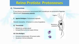 4) Tricomoníase
É uma doença sexualmente transmissível (DST) causada por um protozoário flagelado
denominado Trichomonas vaginalis.
I) Agente Etiológico: Trichomonas vaginalis
Parasita monoxêno: O homem é o único hospedeiro.
II) Transmissão
o Através do contato sexual
o Compartilhamento de roupas íntimas
III) Ciclo Biológico
o Humano contaminado  Humano sadio
o Só possui a forma trofozoíto
Reino Protista: Protozooses
Flagelos
Membrana
ondulante
 