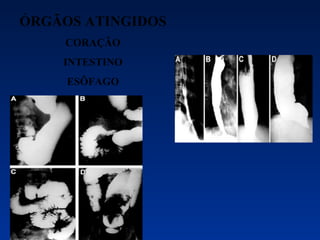 ÓRGÃOS ATINGIDOS CORAÇÃO INTESTINO ESÔFAGO 