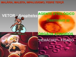 MALÁRIA, MALEITA, IMPALUDISMO, FEBRE TERÇÃ AGENTE ETIOLÓGICO Plasmodium   sp ÓRGÃOS ATINGIDOS “ HEMÁCIAS”-- FÍGADO VETOR  :  Anopheles 