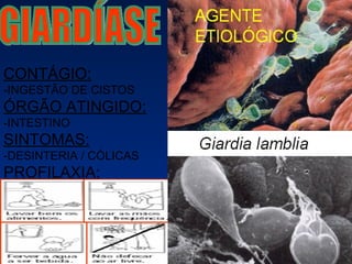 GIARDÍASE CONTÁGIO: -INGESTÃO DE CISTOS ÓRGÃO ATINGIDO: -INTESTINO SINTOMAS: -DESINTERIA / CÓLICAS PROFILAXIA: -IGUAIS A DA AMEBÍSE 