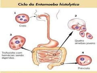 ÓRGÃOS ATINGIDOS INTESTINO FÍGADO CÉREBRO CONTÁGIO INGESTÃO DE CISTOS PROFILAXIA TRATAR A ÁGUA LAVAR FRUTAS, VERDURAS E LEGUMES HIGIENE PESSOAL AMEBÍASE AGENTE ETIOLÓGICO Entamoeba   histolytica SINTOMAS CÓLICA DISENTERIA ? 