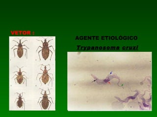 AGENTE ETIOLÓGICO  Trypanosoma   cruzi VETOR :  T riatoma 