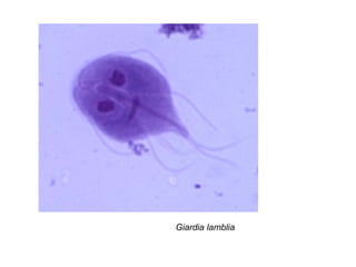 Giardia lamblia
 