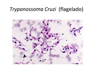 Trypanossoma Cruzi (flagelado)
 