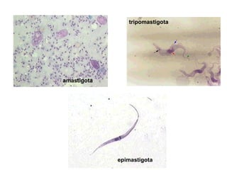 tripomastigota




amastigota




             epimastigota
 