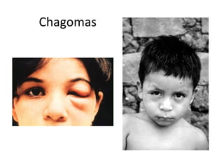 Chagomas
 