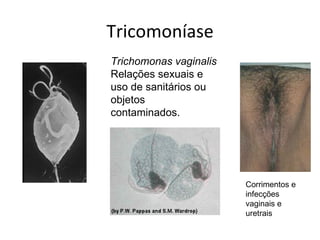 Tricomoníase
Trichomonas vaginalis
Relações sexuais e
uso de sanitários ou
objetos
contaminados.




                        Corrimentos e
                        infecções
                        vaginais e
                        uretrais
 