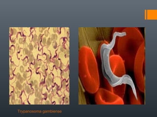 Trypanosoma gambiense

 