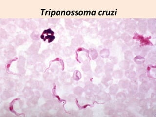 Tripanossoma cruzi 
 