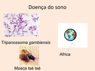 Doença do sono 
Tripanossoma gambiensis 
Africa 
Mosca tsé tsé 
 
