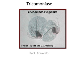 Tricomoníase




 Prof. Eduardo
 