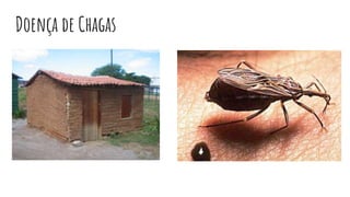 Doença de Chagas
 