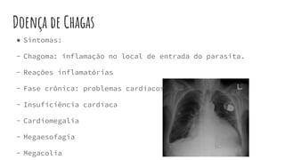 Doença de Chagas
● Sintomas:
- Chagoma: inflamação no local de entrada do parasita.
- Reações inflamatórias
- Fase crônica: problemas cardíacos e intestinais.
- Insuficiência cardíaca
- Cardiomegalia
- Megaesofagia
- Megacolia
 