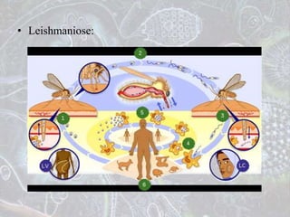 • Leishmaniose:
 